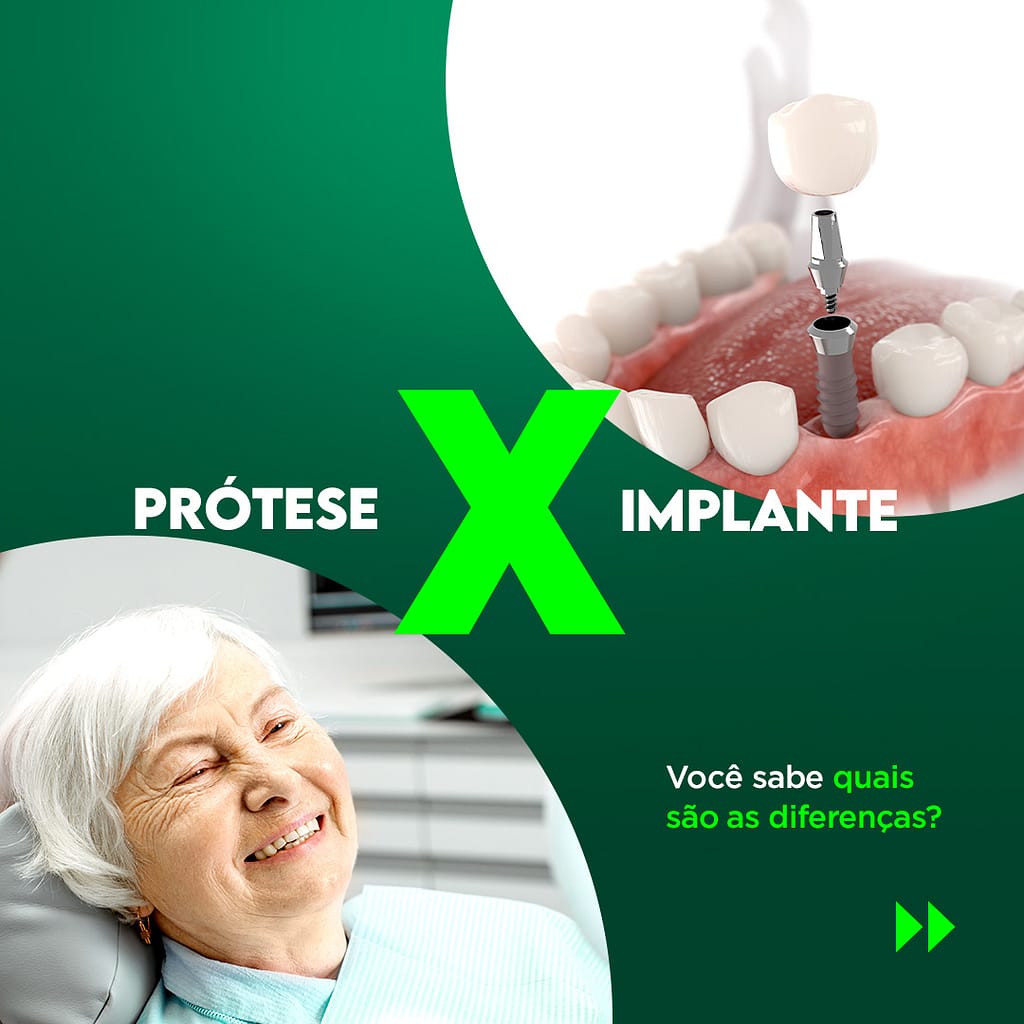 Prótese x Implante, você sabe quais são as diferenças?